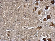 Anti-TMP21 antibody used in IHC (Paraffin sections) (IHC-P). GTX115517