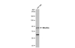 Anti-Mitofilin antibody used in Western Blot (WB). GTX115523