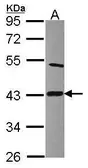 Anti-Lipoic acid synthetase antibody [N1C2] used in Western Blot (WB). GTX115528