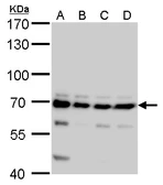 Anti-CPSF6 antibody used in Western Blot (WB). GTX115537