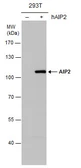 Anti-AIP2 antibody [N1N2], N-term used in Western Blot (WB). GTX115540