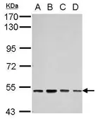 Anti-SOX30 antibody used in Western Blot (WB). GTX115541