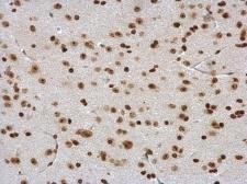 Anti-DDX56 antibody used in IHC (Paraffin sections) (IHC-P). GTX115551