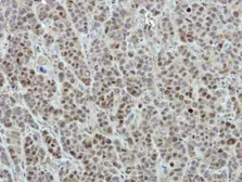 Anti-DDX56 antibody used in IHC (Paraffin sections) (IHC-P). GTX115551