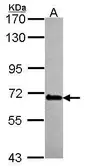 Anti-DDX56 antibody used in Western Blot (WB). GTX115551