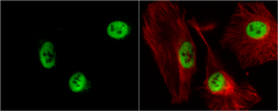 Anti-RbAp48 antibody [N1C2] used in Immunocytochemistry/ Immunofluorescence (ICC/IF). GTX115554
