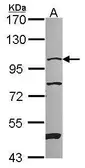 Anti-NARG1 antibody used in Western Blot (WB). GTX115560