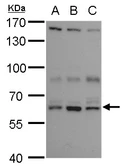 Anti-ANKHD1 antibody [N1], N-term used in Western Blot (WB). GTX115568