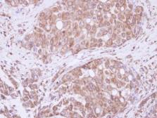 Anti-ATE1 antibody [N1C1] used in IHC (Paraffin sections) (IHC-P). GTX115577