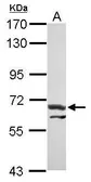 Anti-ATE1 antibody [N1C1] used in Western Blot (WB). GTX115577