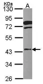 Anti-FGFR1OP antibody [N1C2] used in Western Blot (WB). GTX115580