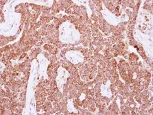 Anti-NUDT3 antibody used in IHC (Paraffin sections) (IHC-P). GTX115595