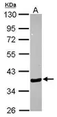 Anti-Annexin A10 antibody [N1C1] used in Western Blot (WB). GTX115600