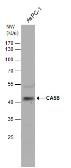 Anti-CA5B antibody used in Western Blot (WB). GTX115604
