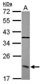 Anti-DCTN3 antibody used in Western Blot (WB). GTX115607