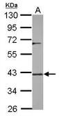 Anti-DUSP12 antibody [N2C3] used in Western Blot (WB). GTX115609