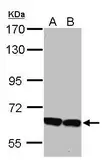 Anti-KLHL2 antibody used in Western Blot (WB). GTX115614