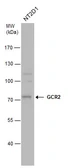 Anti-GCR2 antibody [C1C3] used in Western Blot (WB). GTX115619