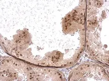Anti-HELIOS antibody used in IHC (Paraffin sections) (IHC-P). GTX115630