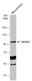 Anti-RASA3 antibody [C2C3], C-term used in Western Blot (WB). GTX115632