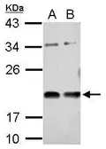 Anti-VASH1 antibody used in Western Blot (WB). GTX115636