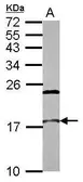 Anti-NCBP2 antibody [N1C3] used in Western Blot (WB). GTX115648