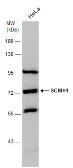 Anti-SCMH1 antibody used in Western Blot (WB). GTX115653