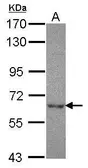 Anti-NT5C2 antibody used in Western Blot (WB). GTX115657