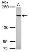 Anti-WAPL antibody [C1C3] used in Western Blot (WB). GTX115664