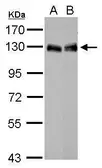 Anti-Lipin 1 antibody [N3C2], Internal used in Western Blot (WB). GTX115676
