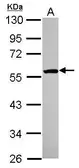 Anti-ETEA antibody [N3C3] used in Western Blot (WB). GTX115680
