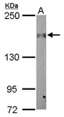 Anti-CLASP1 antibody used in Western Blot (WB). GTX115695