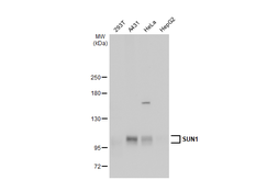 Anti-SUN1 antibody used in Western Blot (WB). GTX115697
