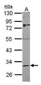 Anti-SIRT3 antibody used in Western Blot (WB). GTX115701