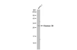 Anti-Elastase 3B antibody used in Western Blot (WB). GTX115702