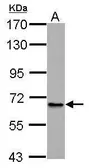Anti-ABCB10 antibody used in Western Blot (WB). GTX115704