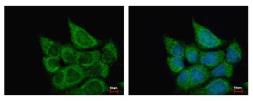 Anti-ETHE1 antibody used in Immunocytochemistry/ Immunofluorescence (ICC/IF). GTX115707
