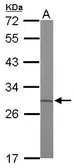 Anti-ETHE1 antibody used in Western Blot (WB). GTX115707