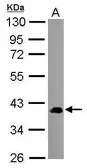 Anti-SEC14L2 antibody used in Western Blot (WB). GTX115716