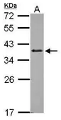 Anti-ZNF346 antibody [N2C3] used in Western Blot (WB). GTX115719