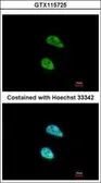 Anti-PATZ1 antibody [N3C2], Internal used in Immunocytochemistry/ Immunofluorescence (ICC/IF). GTX115725