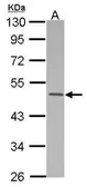Anti-MKRN2 antibody [N1C1] used in Western Blot (WB). GTX115732