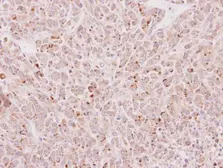 Anti-EDC4 antibody used in IHC (Paraffin sections) (IHC-P). GTX115745
