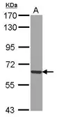 Anti-GADD34 antibody [N1N3] used in Western Blot (WB). GTX115747