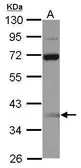 Anti-SSBP3 antibody [N1C1] used in Western Blot (WB). GTX115748