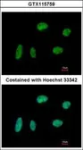 Anti-KIF4A antibody [N1N2], N-term used in Immunocytochemistry/ Immunofluorescence (ICC/IF). GTX115759