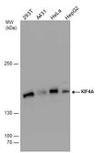 Anti-KIF4A antibody used in Western Blot (WB). GTX115760