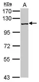 Anti-PRP6 antibody [C1C3] used in Western Blot (WB). GTX115765
