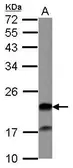Anti-Grancalcin antibody [N1C3] used in Western Blot (WB). GTX115769