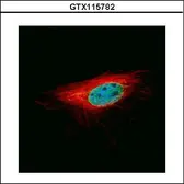 Anti-L3MBTL1 antibody used in Immunocytochemistry/ Immunofluorescence (ICC/IF). GTX115782